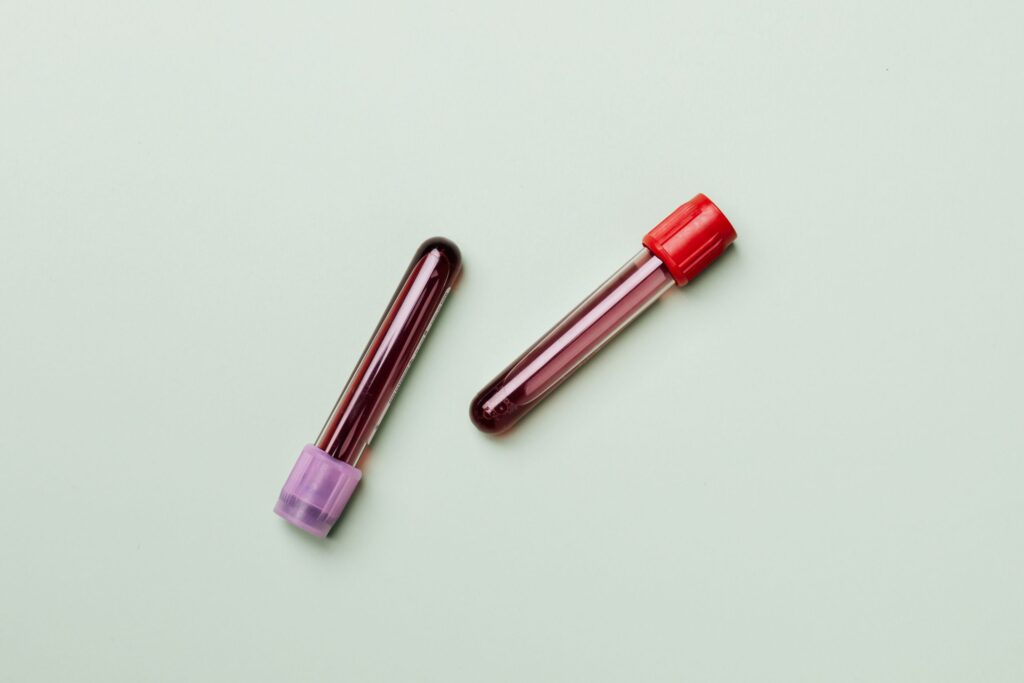 Blood test tubes used for THC detection testing
